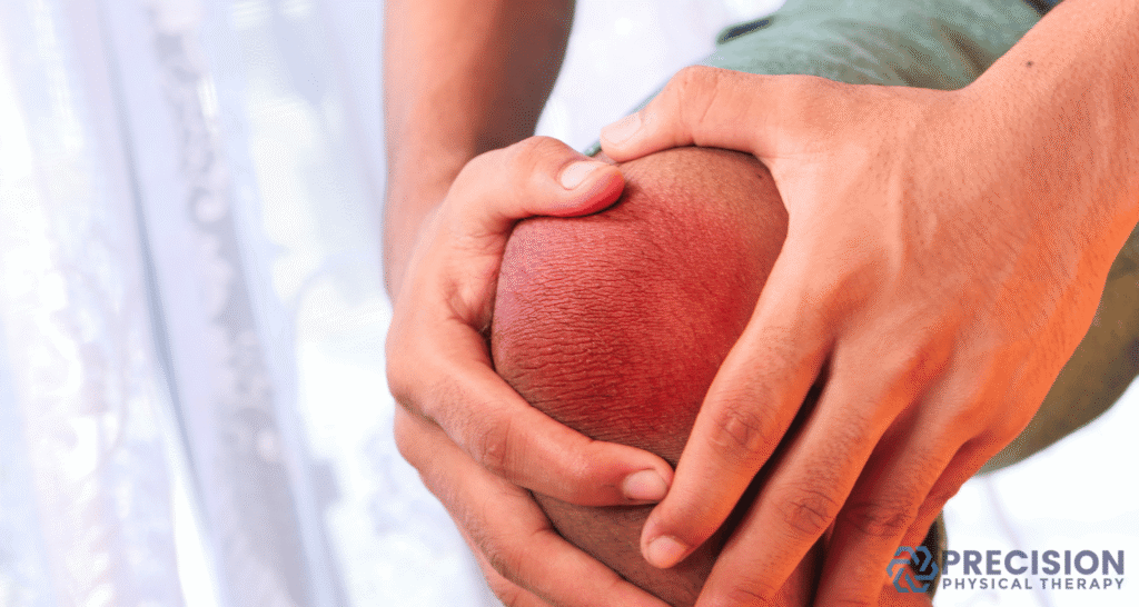 knee pain when squatting